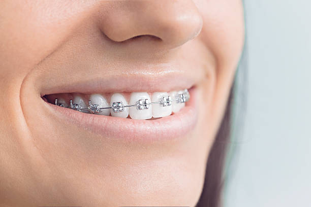 Best Traditional Braces  in Burnet, TX